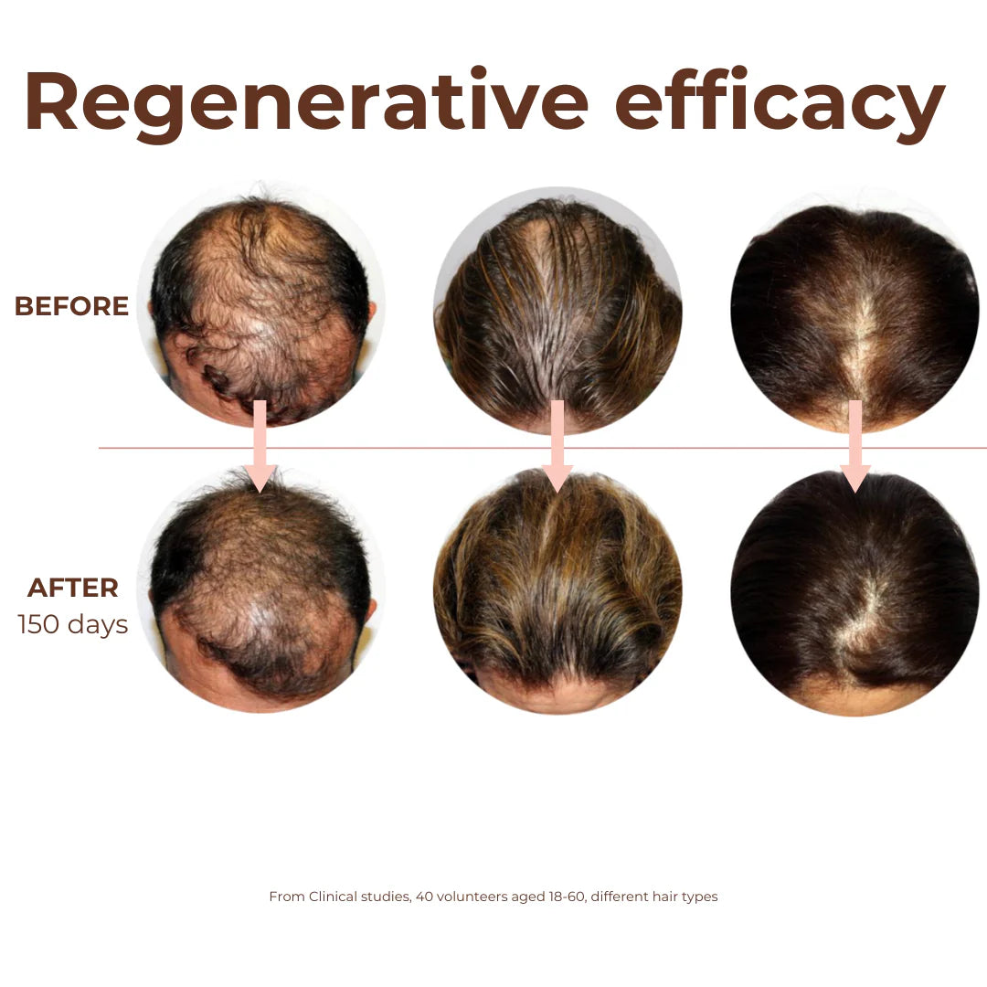 Peptide Miracle Hair Growth Serum
